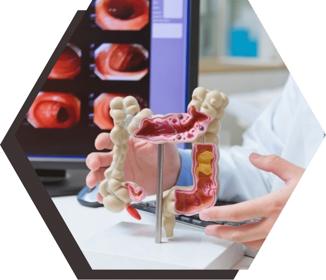 Physician holding a colon model while explaining colorectal cancer screening.